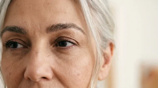 Donna di 60 anni con sopracciglia naturali rinnovate tramite tecnica microchirurgica