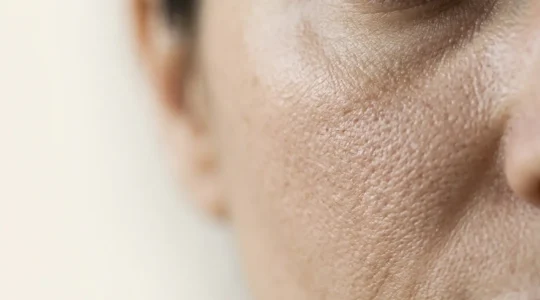 Primo piano di texture cutanea che mostra la grana della pelle e la struttura dei pori